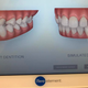 Illustration for article titled Steps Followed For The Best Orthodontic treatment Process At Growing Smiles